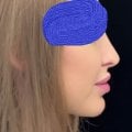 Отзыв о Клиника пластической хирургии ArtPlastic: Современная и безопасная клиника пластической хирургии