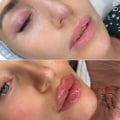 Я участница проекта и победительница