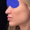Отзыв о Клиника пластической хирургии ArtPlastic: Современная и безопасная клиника пластической хирургии