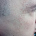 Прекрасный крем, помогает очень хорошо!