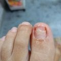 Отзыв о Мазь от Грибка Экзин: Отличная мазь!